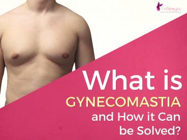 What is Gynecomastia and how it can be solved?