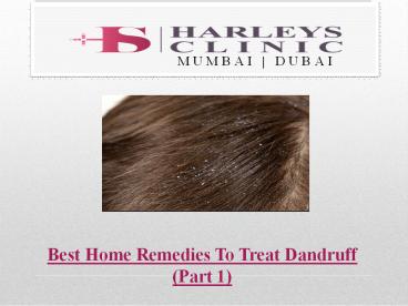 Best Home Remedies To Treat Dandruff (Part 1)
