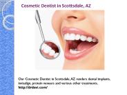 Veneers in Scottsdale, AZ