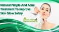 Natural Pimple And Acne Treatment To Improve Skin Glow Safely PowerPoint PPT Presentation