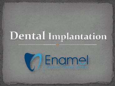 Dental Implantation