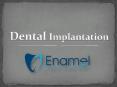 Dental Implantation PowerPoint PPT Presentation