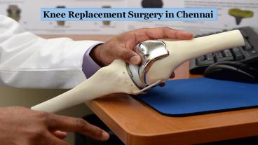 Knee Replacement Surgery in India