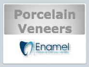 Porcelain Veneers