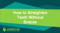 How to Straighten Teeth Without Braces PowerPoint PPT Presentation