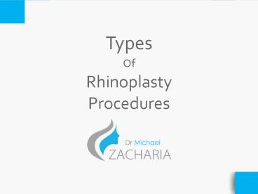 Types of Rhinoplasty Procedures