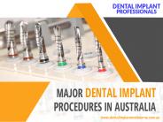 Major Dental Implant Procedures in Australia