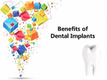Benefits of Dental Implants