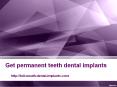 Get Permanent teeth dental implants PowerPoint PPT Presentation