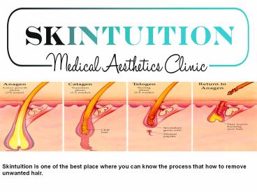 Hair Removal Treatment With Affordable Range