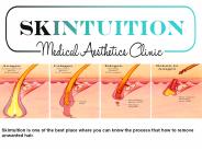 Hair Removal Treatment With Affordable Range