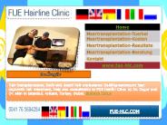 Hair Transplantation Istanbul