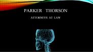 San Diego Brain And Head Injury Attorneys