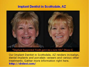Dentures in Scottsdale, AZ