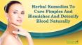Herbal Remedies To Cure Pimples And Blemishes And Detoxify Blood Naturally