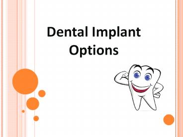 Dental Implant Options