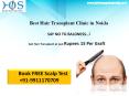 Low Cost Hair Transplant at Rupees 15 per graft in Delhi NCR Contact HOS 9911170709