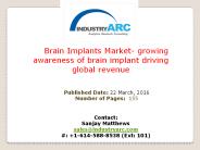 Brain Implant Market Analysis | IndustryARC