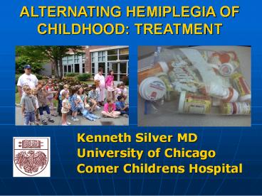 Alternating Hemiplegia of Childhood: Treatment