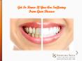 Gum Disease Treatment in San Diego PowerPoint PPT Presentation
