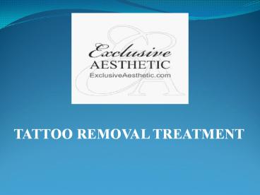 Looking Body tattoo Removal Treatment In Dubai