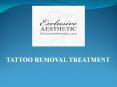 Looking Body tattoo Removal Treatment In Dubai PowerPoint PPT Presentation