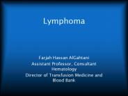Lymphoma