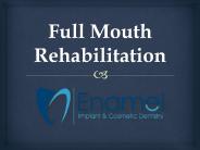 Full Mouth Rehabilitation