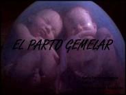 EL PARTO GEMELAR