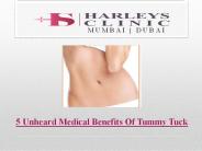 5 Unheard Medical Benefits Of Tummy Tuck