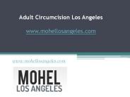 Adult Circumcision Los Angeles - www.mohellosangeles.com