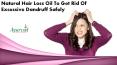 Natural Hair Loss Oil To Get Rid Of Excessive Dandruff Safely PowerPoint PPT Presentation