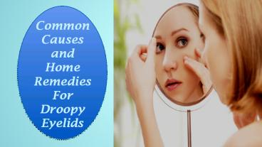 Common Causes and Home Remedies For Droopy Eyelids