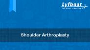 What is Shoulder Arthroplasty- Lyfboat