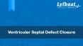 What is Ventricular Septal Defect Closure- Lyfboat PowerPoint PPT Presentation