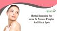 Herbal Remedies For Acne To Prevent Pimples And Black Spots