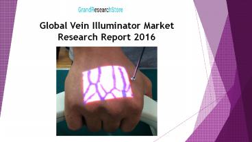 Global Vein Illuminator Market Research Report 2016