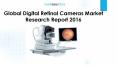 Global Digital Retinal Cameras Market Research Report 2016 PowerPoint PPT Presentation