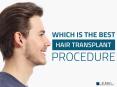 Best Hair Transplant, Hair Restoration Surgery in Hyderabad PowerPoint PPT Presentation