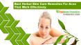 Best Herbal Skin Care Remedies For Acne That Work Effectively