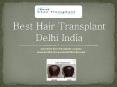 Best Hair Transplant FUE, FUT, Eyebrow Delhi, Hair Loss Treatment India PowerPoint PPT Presentation