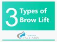 3 Types of Brow Lift PowerPoint PPT Presentation