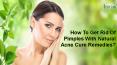How To Get Rid Of Pimples With Natural Acne Cure Remedies? PowerPoint PPT Presentation