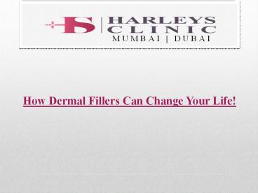 How Dermal Fillers Can Change Your Life!