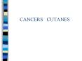 CANCERS%20%20CUTANES PowerPoint PPT Presentation