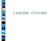 CANCERS%20%20CUTANES