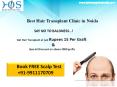 Hair Transplant at Rupees 15 per graft in Noid and Delhi Contact HOS 9911170709