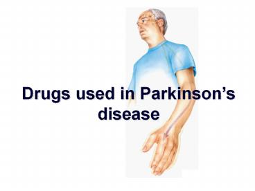 Parkinson