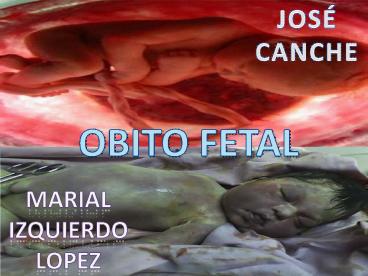 OBITO FETAL