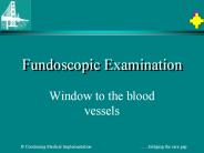 Fundoscopic Examination